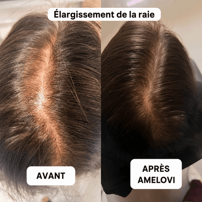 Amelovi® Rituel Coréen de Réveil du Cuir Chevelu
