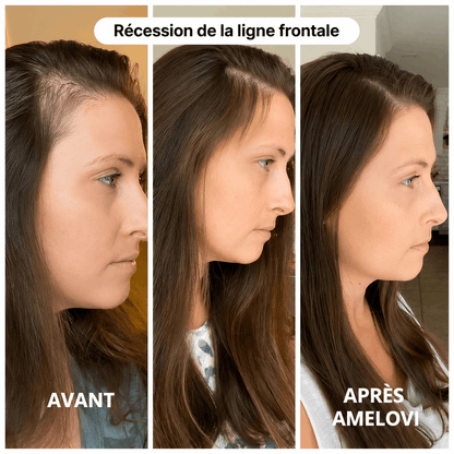 Amelovi® Rituel Coréen de Réveil du Cuir Chevelu
