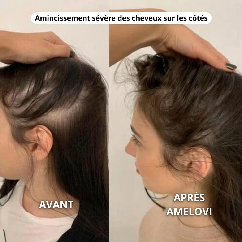 Amelovi® Rituel Coréen de Réveil du Cuir Chevelu