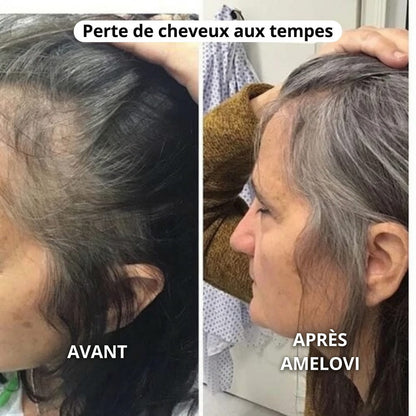 Amelovi® Rituel Coréen de Réveil du Cuir Chevelu