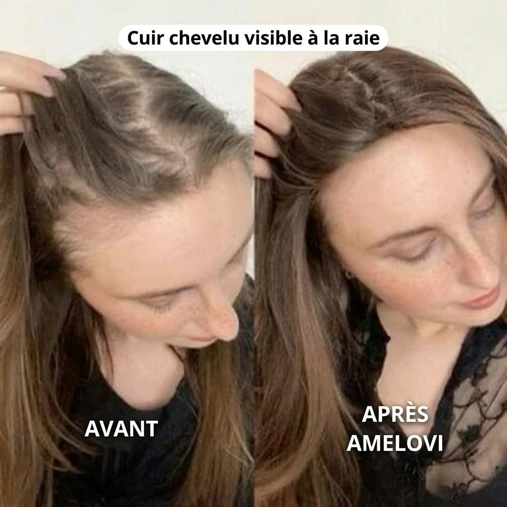 Amelovi® Rituel Coréen de Réveil du Cuir Chevelu